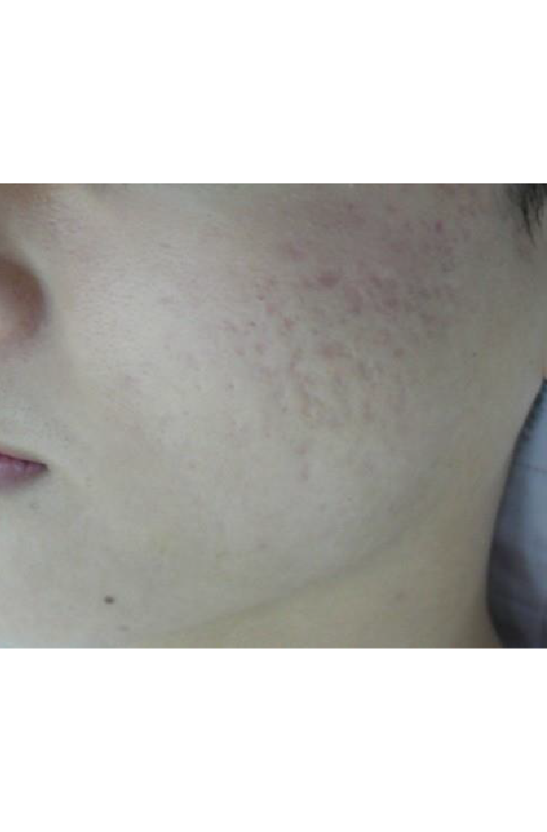 After