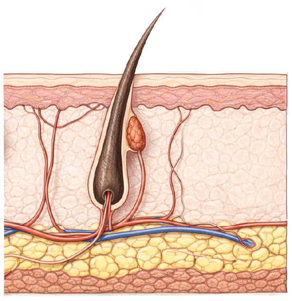 Skin depth diagram showing Nd:YAG, Alexandrite, and KTP laser penetration levels