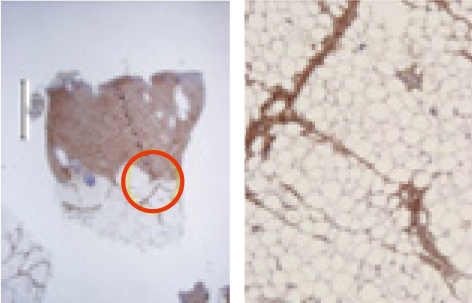 Day 28 IHC collagen evaluation figure 2