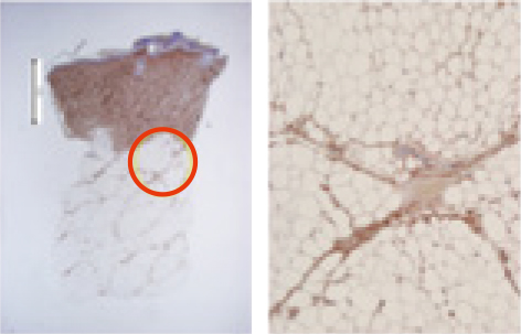 Day 14 IHC collagen evaluation figure 1
