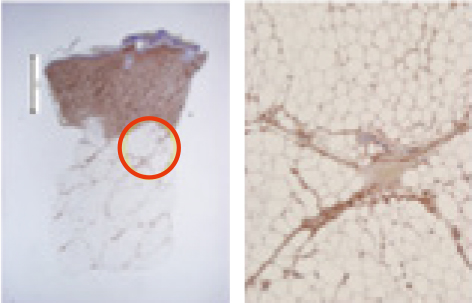 Day 14 IHC collagen evaluation figure 2