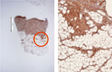 Day 14 IHC collagen evaluation figure 3