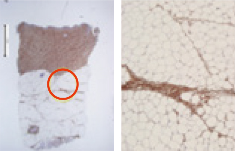 Day 28 IHC collagen evaluation figure 1