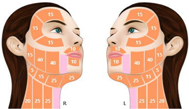 Facial treatment-area diagram for the 1.5 mm cartridge